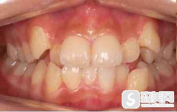 张益医生怎么样?张益医生在哪家医院?张益医生案例分享