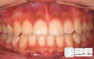 张益医生怎么样?张益医生在哪家医院?张益医生案例分享