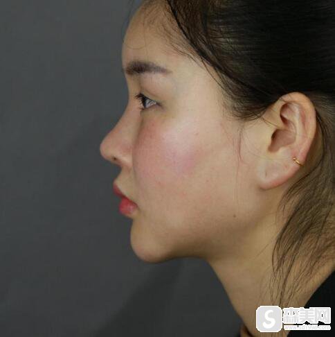 网友心中的好大夫梁成怎么样?梁成医生案例