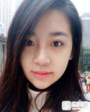 较好玻尿酸品牌排行榜?成都美莱隆鼻恢复图