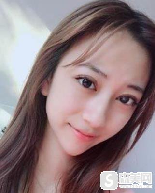 陈誉华院长打玻尿酸打得好的吗?附下巴填充详情对比