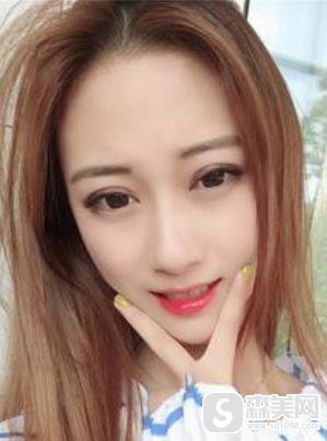 陈誉华院长打玻尿酸打得好的吗?附下巴填充详情对比