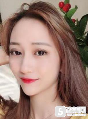 陈誉华院长打玻尿酸打得好的吗?附下巴填充详情对比