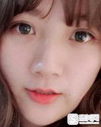 九院打玻尿酸丰唇果?术后恢复浏览