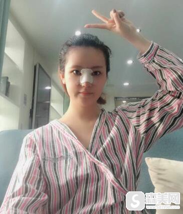 宋国栋医生怎么样?朋友问有没有真实案例分享呢？