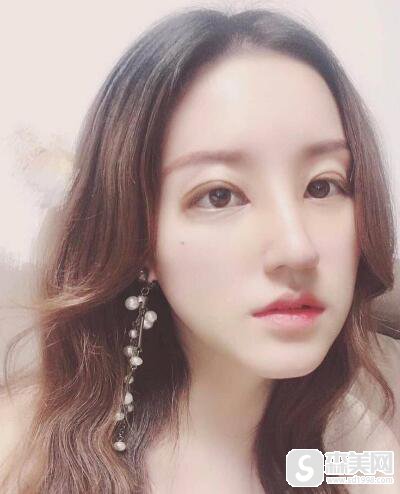 宋国栋医生怎么样?朋友问有没有真实案例分享呢？