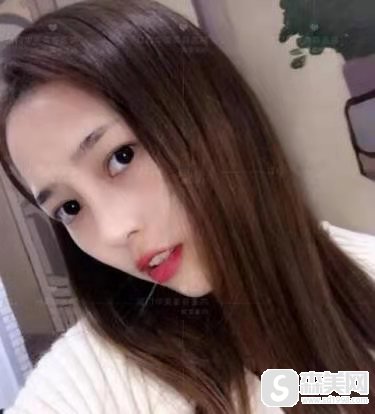 上海较出名的隆鼻医生是谁？隆鼻果好吗？隆鼻案例分享