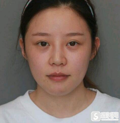 潘宝华医生怎么样?他的成功案例有哪些?