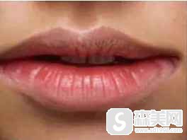 男生纹唇前后对比照片,纹唇需要注意点什么?