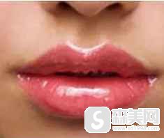 男生纹唇前后对比照片,纹唇需要注意点什么?