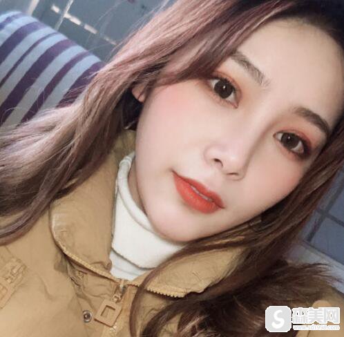 田凯月医生颌骨畸形矫正案例,技术如何?真实案例分享