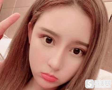 安徽医科大学第一附属医院的口碑如何?主要医生团队有谁?_赵宇医生_案例_鼻部整形