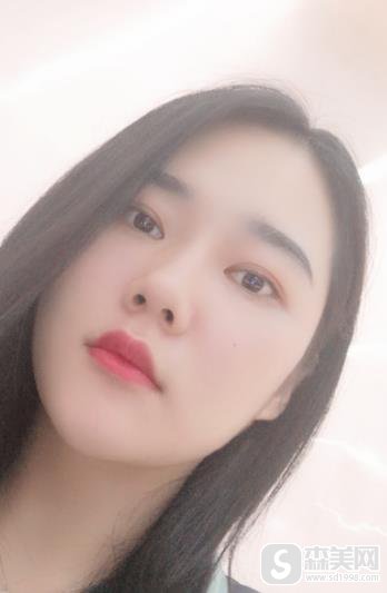 九院打玻尿酸隆鼻多少钱?附术后3个月恢复记录