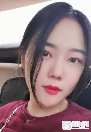 九院打玻尿酸隆鼻多少钱?附术后3个月恢复记录