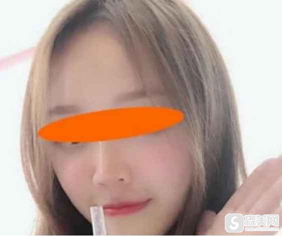2021宁波美莱的价目表出炉,有较新较真实的案例分享,附术后图片
