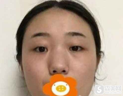 北京基恩医院整形技术怎么样?附推荐医生介绍,该医院整形果图