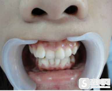 北京普瑞美口腔门诊部口碑如何？附详细介绍和牙齿整形前后对比图