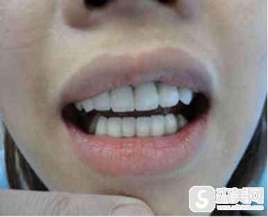 北京普瑞美口腔门诊部口碑如何？附详细介绍和牙齿整形前后对比图