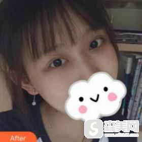 福建医科大学附属协和医院的口碑怎么样?_医院简介_周亚宽副主任_擅长项目案例