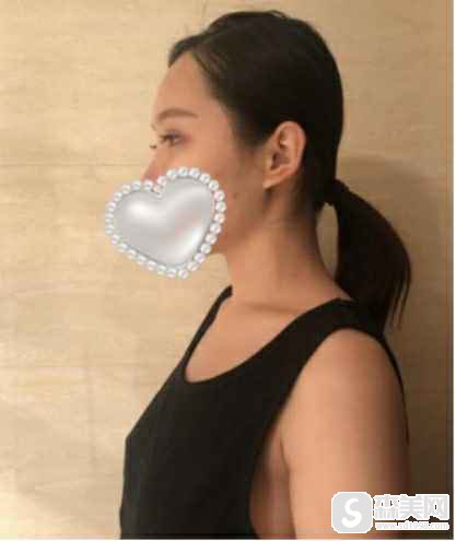 杭州丰胸优选格莱美,口碑如何?附格莱美简介,真实隆胸果图