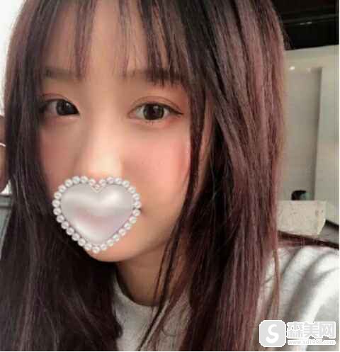 杭州同同荣丽格做的双眼皮,与我的小眼,彻底说再见!附双眼皮案例前后对比图