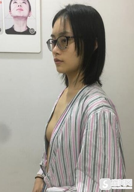 想成女神?请来沧州美神!美神医疗隆胸案例分享!附术后果图