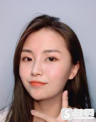 上海九院c8激光祛斑怎么样?前后对比图