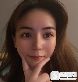 太原华美整形医院肋软骨隆鼻详情?整形科90天恢复一览