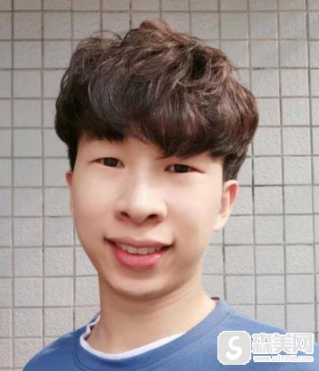 南京雅度口腔医院隐形矫正时间久吗?前后恢复图片对比