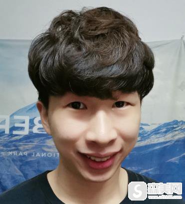 南京雅度口腔医院隐形矫正时间久吗?前后恢复图片对比