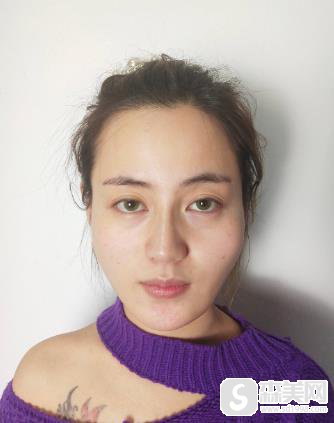 颧弓外扩的女明星有谁?上海九院给我拯救了我的轮廓