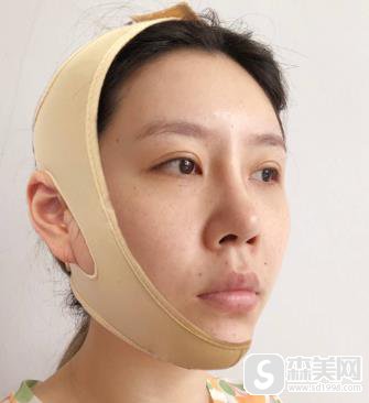 颧弓突出怎么办啊?手术前后对比图