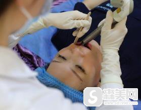 欧洲之星认证医生王晓璇案例?附手术前后对比