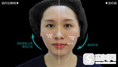 欧洲之星认证医生王晓璇案例?附手术前后对比