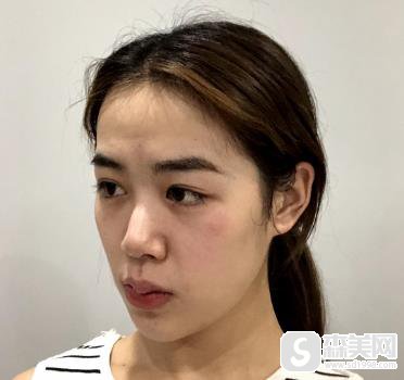 欧洲之星官网认证医生郭芳如何？恢复记录浏览