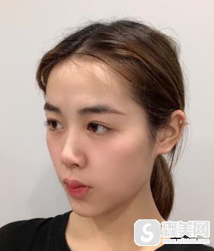 欧洲之星官网认证医生郭芳如何？恢复记录浏览