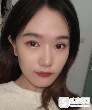 欧洲之星fotona售价贵不贵?上海九院恢复记录