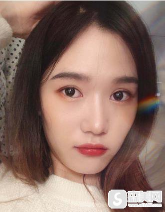 欧洲之星fotona售价贵不贵?上海九院恢复记录