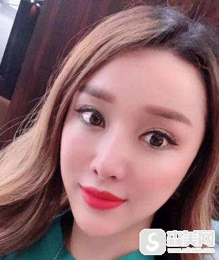 欧洲之星4d做一次果怎么样？附案例对比