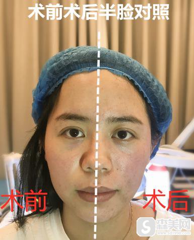 北京八大处欧洲之星4d做一次多少钱?附真实案例对比照