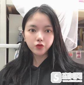 欧洲之星4d认证医生麦晓婷案例分享?附前后对比图