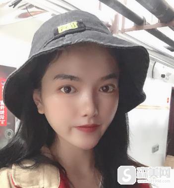 欧洲之星4d认证医生麦晓婷案例分享?附前后对比图