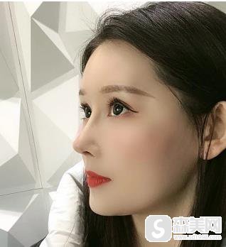 欧洲之星4d抗衰多久做一次？北京京民真是案例分享？