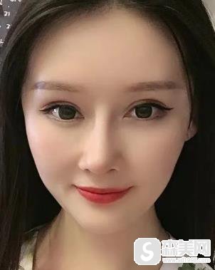 欧洲之星4d抗衰多久做一次？北京京民真是案例分享？