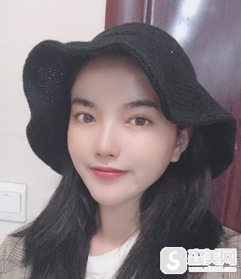 欧洲之星4d认证医生麦晓婷案例分享?附前后对比图