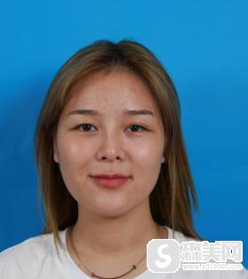 欧洲之星4d和热玛吉区别是什么?华美抗衰案例分享