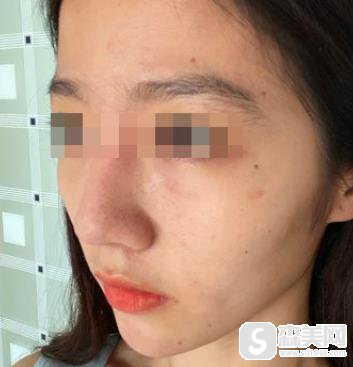 南京东南大学附属中大医院可以打水光补水吗?附果图浏览