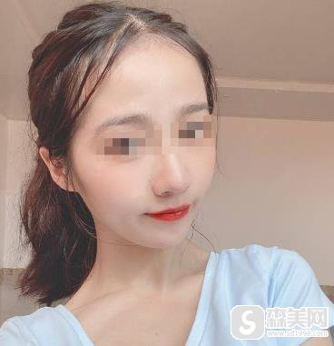 南京东南大学附属中大医院可以打水光补水吗?附果图浏览