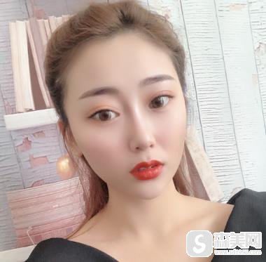 南京医科大学第二附属医院水光补水果？恢复果图对比