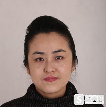 南昌水光补水要去同济整形妙手？附术后恢复记录